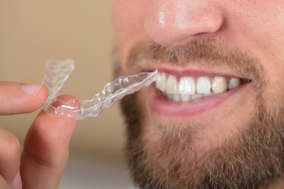 man smiling while holding clear dental aligners